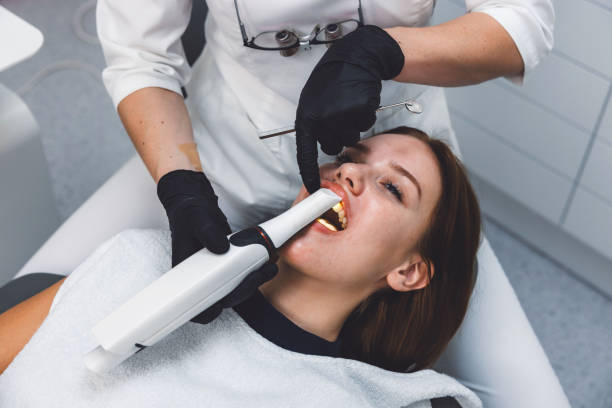 Best Emergency Dental Extractions in Lifornia City, CA